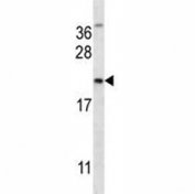 MUC-1 antibody western blot analysis in NCI-H292 lysate. This Ab will detect the 17-28 kDa isoforms as well as full length MUC1.
