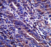 MUC-1 antibody immunohistochemistry analysis in formalin fixed and paraffin embedded human stomach tissue.