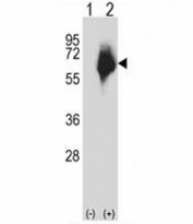 Western blot analysis of MMP2 antibody and 293 cell lysate either nontransfected (Lane 1) or transiently transfected (2) with the MMP2 gene. Expected molecular weight: ~72 kDa (pro form), ~63 kDa (cleaved form).