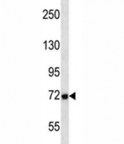 MMP2 antibody western blot analysis in T47D lysate. Expected molecular weight: ~72 kDa (pro form), ~63 kDa (cleaved form).