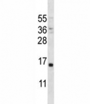 PTH antibody western blot analysis in MDA-MB231 lysate.