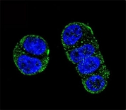 Confocal immunofluorescent analysis of PSMA antibody with ZR-75-1 cells followed by Alexa Fluor 488-conjugated goat anti-rabbit lgG (green). DAPI was used as a nuclear counterstain (blue).