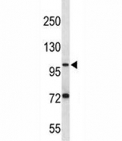 PSMA antibody western blot analysis in ZR-75-1 lysate. Observed molecular weight ~ 100 kDa.