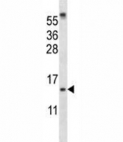 SUMO-1 antibody western blot analysis in ZR-75-1 lysate