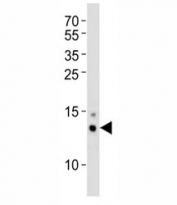 Western blot analysis of lysate from mouse Neuro-2a cell line using SUMO-1 antibody at 1:1000 for each lane. Predicted molecular weight: 12-15 kDa
