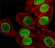 Fluorescent image of A549 cell stained with SUMO-1 antibody at 1:25. SUMO1 immunoreactivity is localized to the nuclear membrane.