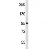 HDAC4 antibody western blot analysis in NCI-H292 lysate. Expected molecular weight: ~140 kDa (full length), ~95 kDa (truncated).