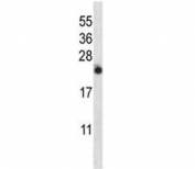 IL-13 antibody western blot analysis in NCI-H460 lysate. Expected molecular weight: 16-35 kDa depending on level of glycosylation.