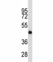 OPG antibody western blot analysis in NCI-H460 lysate.