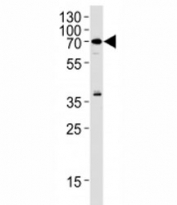 RIPK2 antibody western blot analysis in Raji lysate