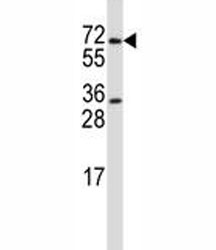 PRMT5 antibody western blot analysis in HL-60 lysate.~