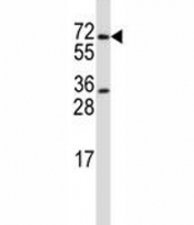PRMT5 antibody western blot analysis in HL-60 lysate. Expected molecular weight ~72kDa.