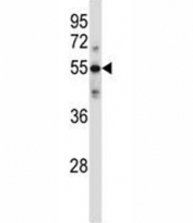 C9 antibody western blot analysis in ZR-75-1 lysate