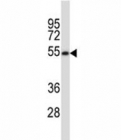MAVS antibody western blot analysis in HeLa lysate. Predicted molecular weight: 51-54 kDa (cleaved), 57 kDa (unmodified), 75 kDa (aggregated).