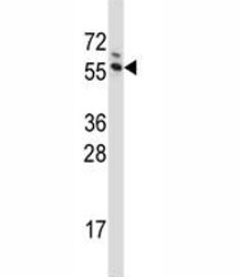 G3BP1 antibody western blot analysis in Jurkat lysate~