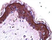 S100A7 antibody immunohistochemistry analysis in formalin fixed and paraffin embedded human skin tissue.