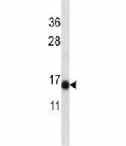 S100A7 antibody western blot analysis in NCI-H292 lysate. Predicted molecular weight: 11-13 kDa.