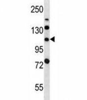 LRIG2 antibody western blot analysis in mouse bladder tissue lysate.