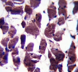 LRIG2 antibody immunohistochemistry analysis in formalin fixed and paraffin embedded human skeletal muscle.~