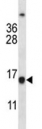 BCL2 antibody western blot analysis in Jurkat lysate