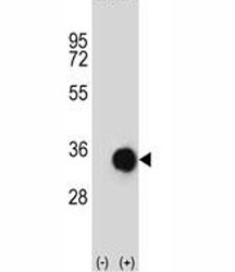 Western blot analysis of Caspase-6 antibody and 293 cell lysate (2 ug/lane) either nontransfected (Lane 1) or transiently transfected (2) with the CASP6 gene.~