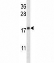 MGMT antibody western blot analysis in CEM lysate.