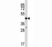 CCR9 antibody western blot analysis in MDA-MB435 lysate