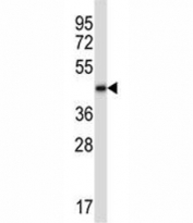 BMP2 antibody western blot analysis in human CEM lysate. Expected molecular weight: 13-14 kDa per monomer.