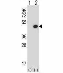 Western blot analysis of BMP7 antibody and 293 cell lysate either nontransfected (Lane 1) or transiently transfected (2) with the BMP7 gene. Predicted molecular weight: 47 kDa protein cleaved into ~33 and ~15 kDa segments.