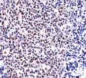 NFATC1 antibody immunohistochemistry analysis in formalin fixed and paraffin embedded human tonsil tissue.