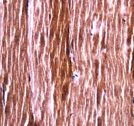 Akt2 antibody immunohistochemistry analysis in formalin fixed and paraffin embedded mouse skeletal muscle.