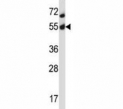 Akt2 antibody western blot analysis in MCF-7 lysate. Predicted molecular weight: ~56kDa.