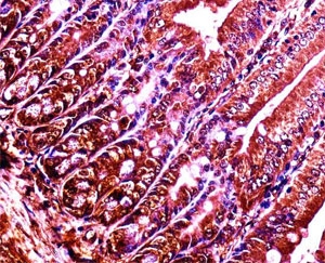 Abl1 antibody immunohistochemistry analysis in formalin fixed and paraffin embedded mouse duodenum tissue.