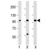Csf1r antibody western blot analysis in 1) mouse skeletal muscle, 2) mouse heart and 3) rat skeletal muscle tissue lysate. Predicted molecular weight: 106-116 kDa.