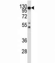 Csf1r antibody western blot analysis in mouse heart tissue lysate. Predicted molecular weight: 106-116 kDa.