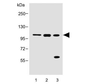 Western blot testing of 1) mouse heart, 2) mouse skeletal muscle and 3) rat skeletal muscle lysate with Csf1r antibody. Predicted molecular weight: 106-116 kDa.