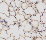 IHC testing of FFPE mouse lung tissue with Csf1r antibody at 1:25 dilution. HIER: steamed antigen retrieval with pH6 citrate buffer.