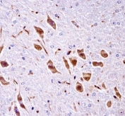PAK3 antibody immunohistochemistry analysis in formalin fixed and paraffin embedded mouse brain tissue.