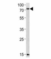 Western blot analysis of lysate from mouse NIH3T3 cell line using PAK3 antibody diluted at 1:1000 for each lane. Expected molecular weight ~62 kDa.