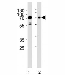 Western blot analysis of lysate from human 1) HeLa, and 2) Jurkat cell line using PAK3 antibody at 1:1000.