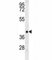 TRAF1 antibody western blot analysis in NCI-H460 lysate.