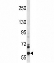 NOX5 antibody western blot analysis in CEM lysate. Predicted molecular weight: ~86kDa, observed here at ~60kDa. We cannot explain the size discrepancy.