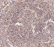 IHC staining of FFPE human spleen tissue with CD163L1 antibody. HIER: boil tissue sections in pH 9 10mM Tris with 1mM EDTA for 20 min and allow to cool before testing.