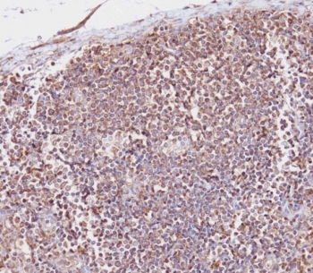 IHC staining of FFPE human lymph node tissue with CD163L1 antibody. HIER: boil tissue sections in pH 9 10mM Tris with 1mM EDTA for 20 min and allow to cool before testing.