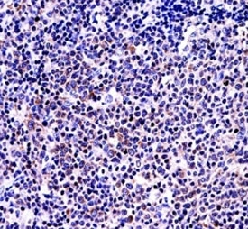 BAFF antibody immunohistochemistry analysis in formalin fixed and paraffin embedded human tonsil tissue.~