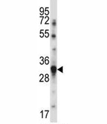 BAFF antibody western blot analysis in MDA-MB231 lysate.