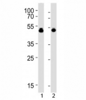 VASP antibody western blot analysis with 1) HUVEC and 2) THP-1 lysate. Expected molecular weight:  ~40/46-50 kDa (unmodified/phosphorylated).