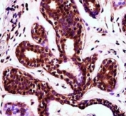 PDCD4 antibody immunohistochemistry analysis in formalin fixed and paraffin embedded human breast tissue.