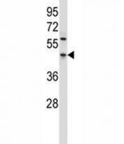 PDCD4 antibody western blot analysis in HL-60 lysate. Expected molecular weight: 50-60 kDa.