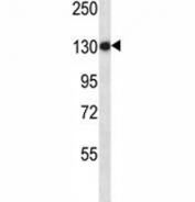 Anti-TLR8 antibody western blot analysis in NCI-H460 lysate. Expected molecular weight ~120 kDa.